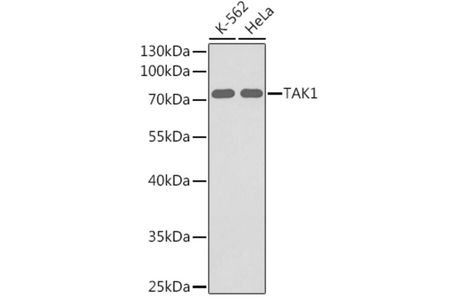 Western Blot - Anti-TAK1 Antibody (A12713) - Antibodies.com