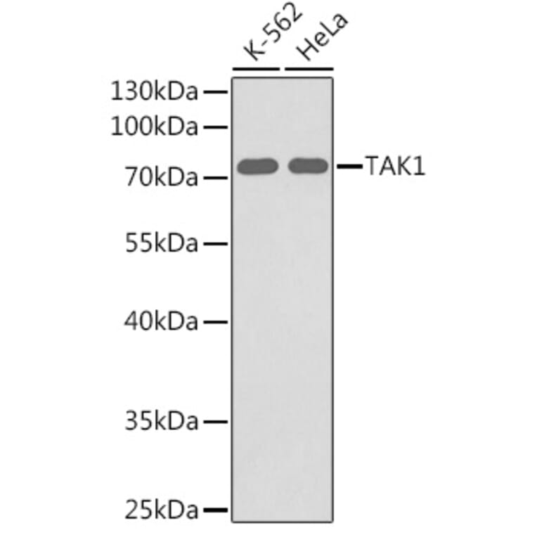 Western Blot - Anti-TAK1 Antibody (A12713) - Antibodies.com