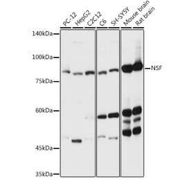 Western Blot - Anti-N-ethylmaleimide-sensitive fusion protein Antibody (A12714) - Antibodies.com