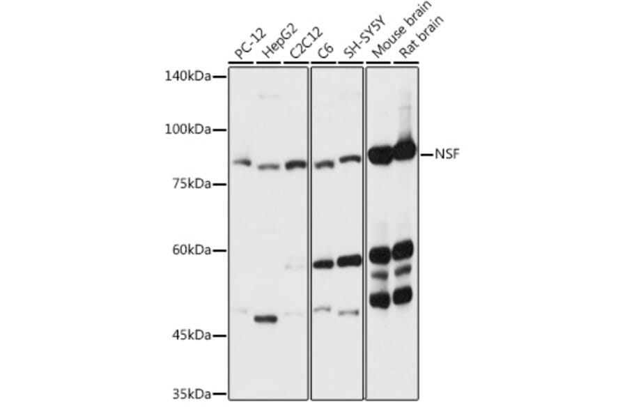 Western Blot - Anti-N-ethylmaleimide-sensitive fusion protein Antibody (A12714) - Antibodies.com