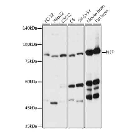 Western Blot - Anti-N-ethylmaleimide-sensitive fusion protein Antibody (A12714) - Antibodies.com