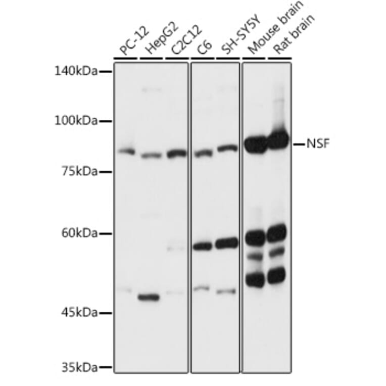Western Blot - Anti-N-ethylmaleimide-sensitive fusion protein Antibody (A12714) - Antibodies.com