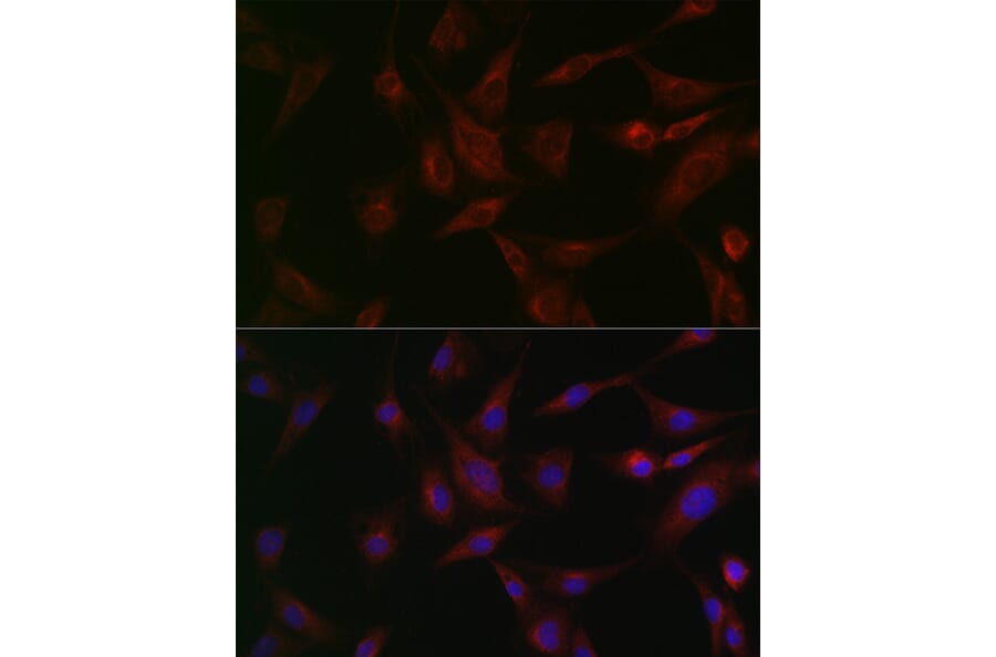 Immunofluorescence - Anti-N-ethylmaleimide-sensitive fusion protein Antibody (A12714) - Antibodies.com