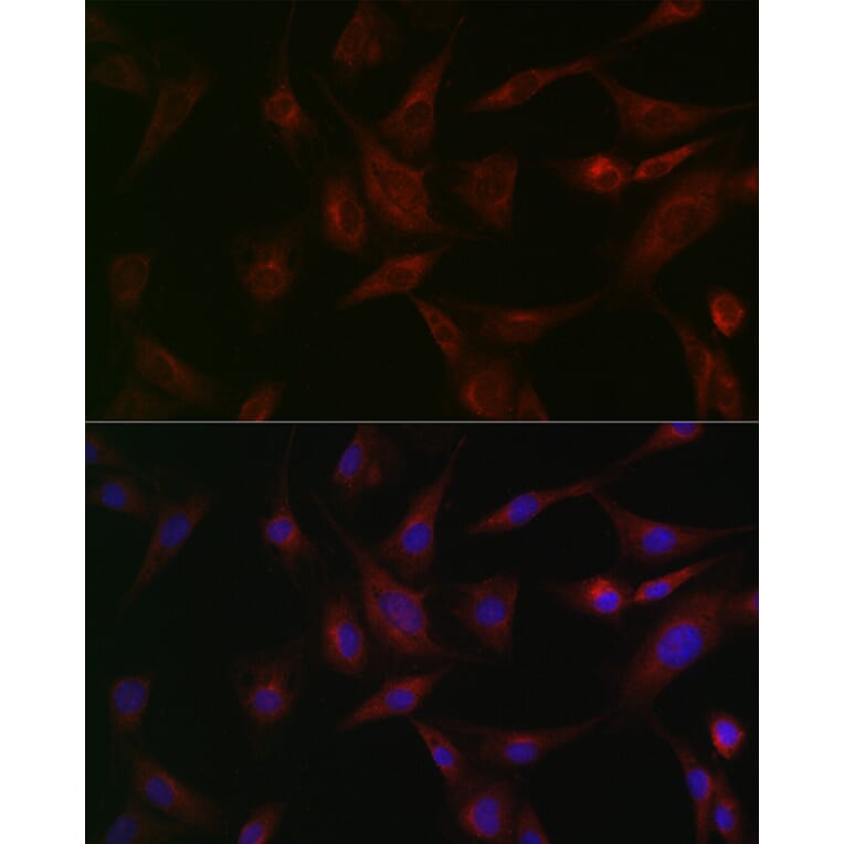 Immunofluorescence - Anti-N-ethylmaleimide-sensitive fusion protein Antibody (A12714) - Antibodies.com