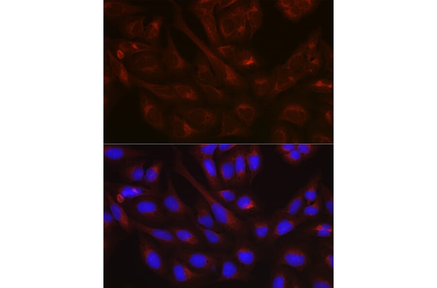 Immunofluorescence - Anti-N-ethylmaleimide-sensitive fusion protein Antibody (A12714) - Antibodies.com