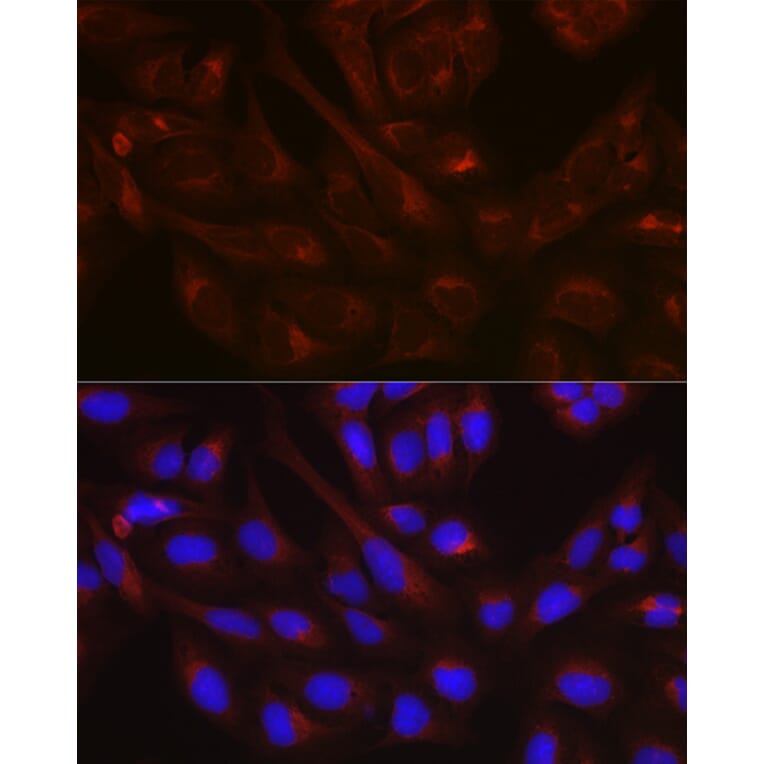 Immunofluorescence - Anti-N-ethylmaleimide-sensitive fusion protein Antibody (A12714) - Antibodies.com