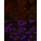Immunofluorescence - Anti-N-ethylmaleimide-sensitive fusion protein Antibody (A12714) - Antibodies.com