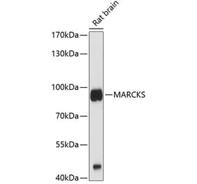 Western Blot - Anti-MARCKS Antibody (A12716) - Antibodies.com
