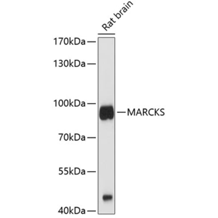 Western Blot - Anti-MARCKS Antibody (A12716) - Antibodies.com