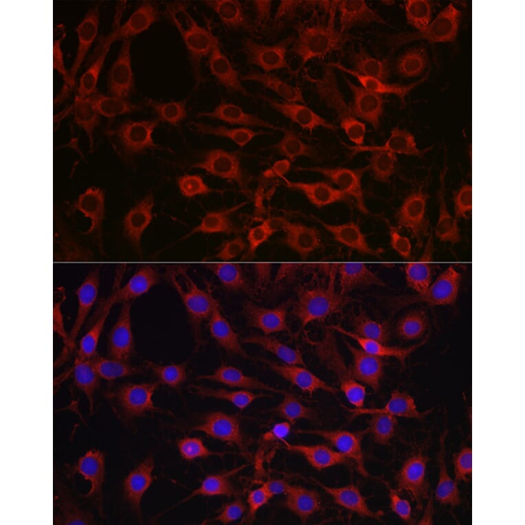 Immunofluorescence - Anti-MARCKS Antibody (A12716) - Antibodies.com