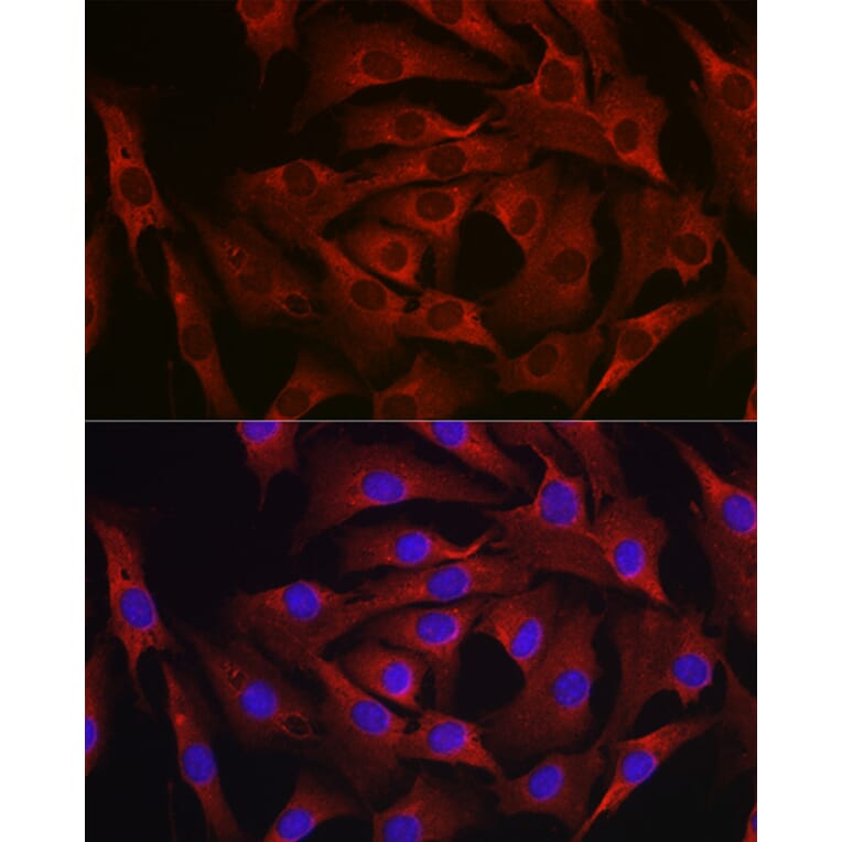 Immunofluorescence - Anti-MARCKS Antibody (A12716) - Antibodies.com