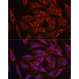 Immunofluorescence - Anti-MARCKS Antibody (A12716) - Antibodies.com