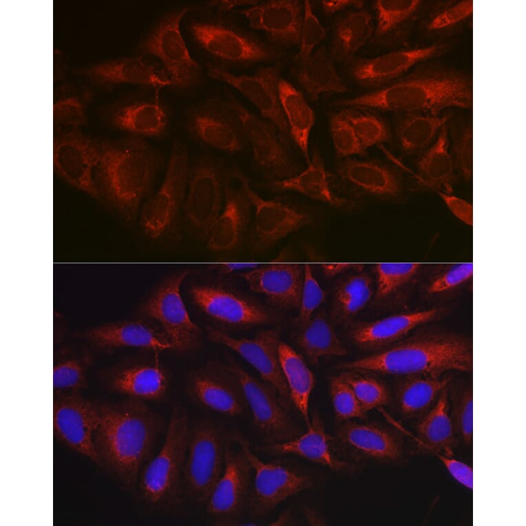 Immunofluorescence - Anti-MARCKS Antibody (A12716) - Antibodies.com
