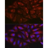 Immunofluorescence - Anti-MARCKS Antibody (A12716) - Antibodies.com