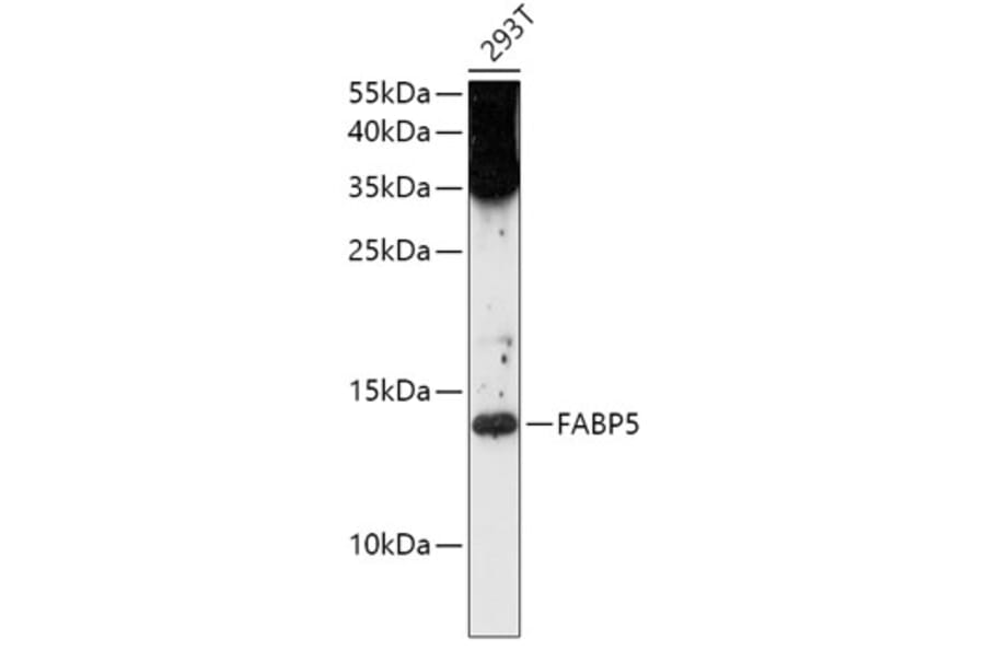 Western Blot - Anti-FABP5 Antibody (A12717) - Antibodies.com