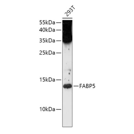 Western Blot - Anti-FABP5 Antibody (A12717) - Antibodies.com