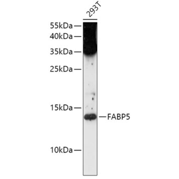 Western Blot - Anti-FABP5 Antibody (A12717) - Antibodies.com