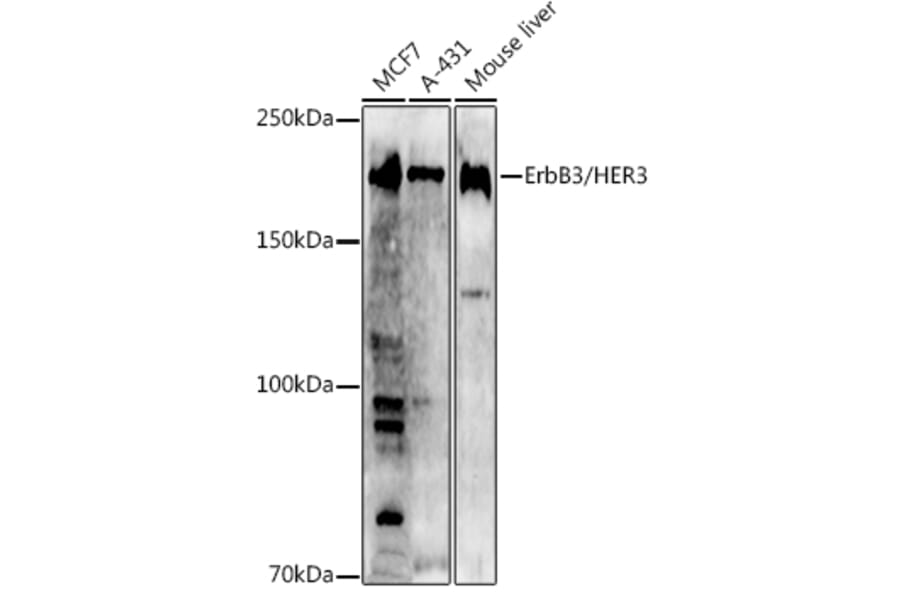 Western Blot - Anti-ErbB3/HER3 Antibody (A12718) - Antibodies.com