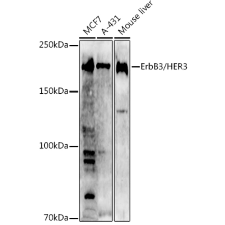 Western Blot - Anti-ErbB3/HER3 Antibody (A12718) - Antibodies.com