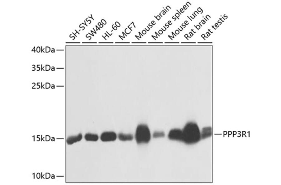 Western Blot - Anti-Calcineurin B/CNB Antibody (A12720) - Antibodies.com