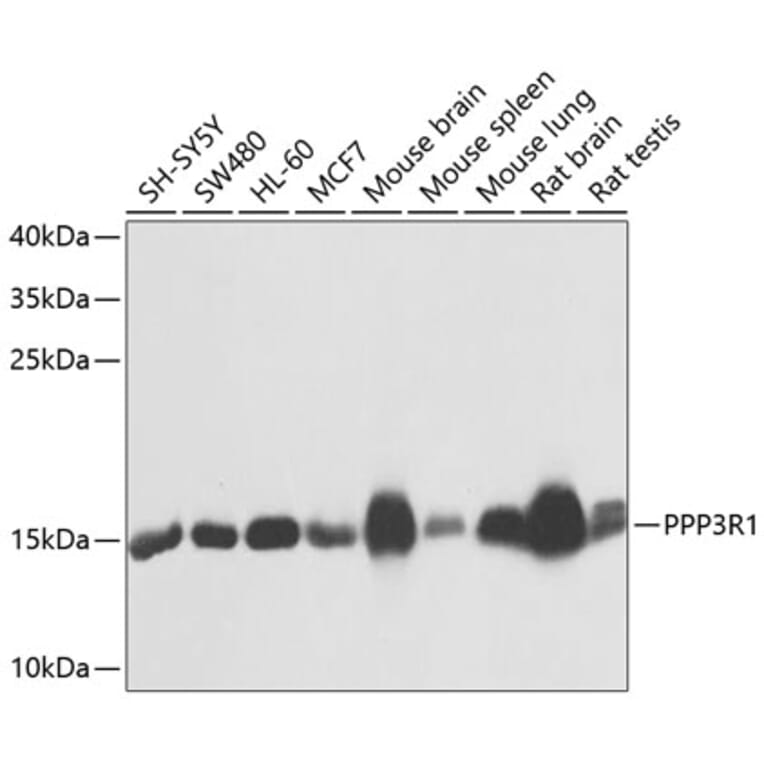 Western Blot - Anti-Calcineurin B/CNB Antibody (A12720) - Antibodies.com