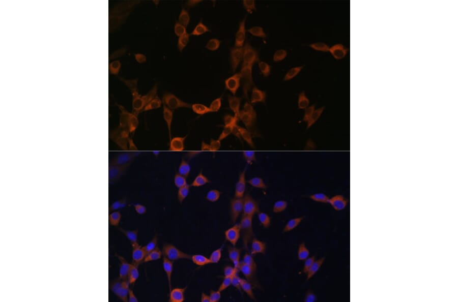 Immunofluorescence - Anti-Calcineurin B/CNB Antibody (A12720) - Antibodies.com