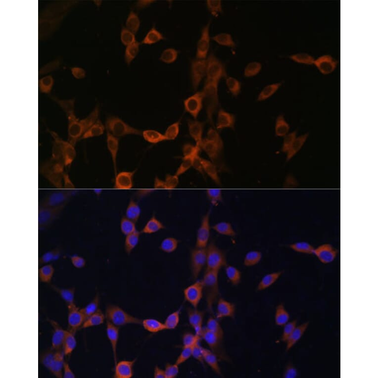 Immunofluorescence - Anti-Calcineurin B/CNB Antibody (A12720) - Antibodies.com