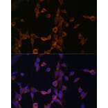 Immunofluorescence - Anti-Calcineurin B/CNB Antibody (A12720) - Antibodies.com