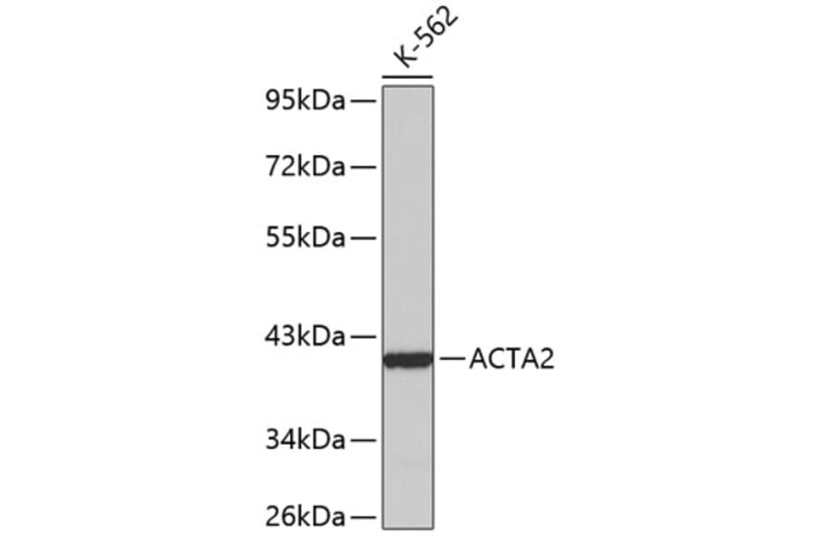 Western Blot - Anti-ACTA2 Antibody (A0957) - Antibodies.com