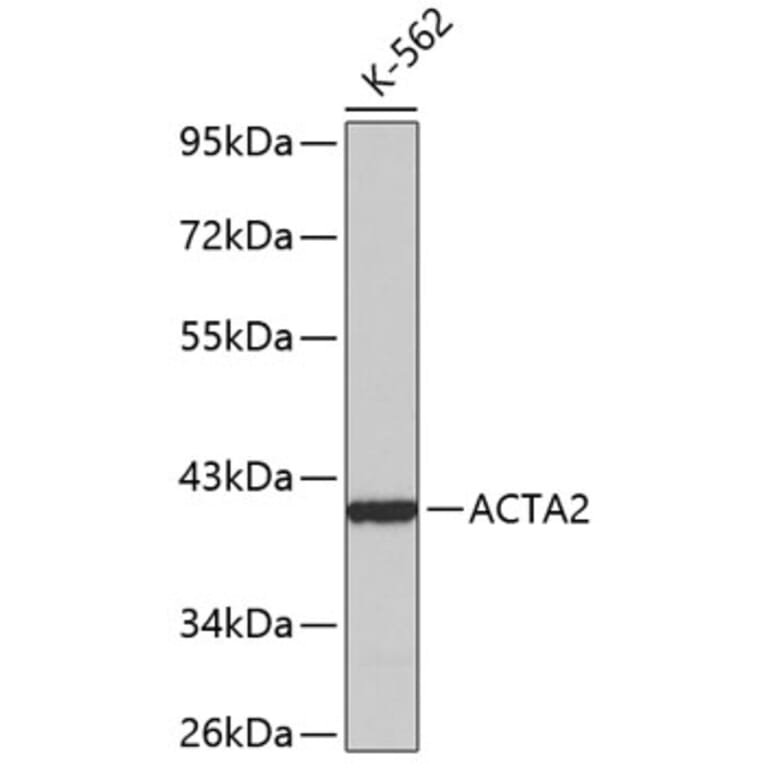 Western Blot - Anti-ACTA2 Antibody (A0957) - Antibodies.com