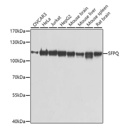 Western Blot - Anti-SFPQ Antibody (A12722) - Antibodies.com