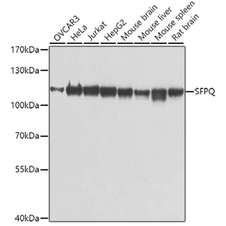 Western Blot - Anti-SFPQ Antibody (A12722) - Antibodies.com