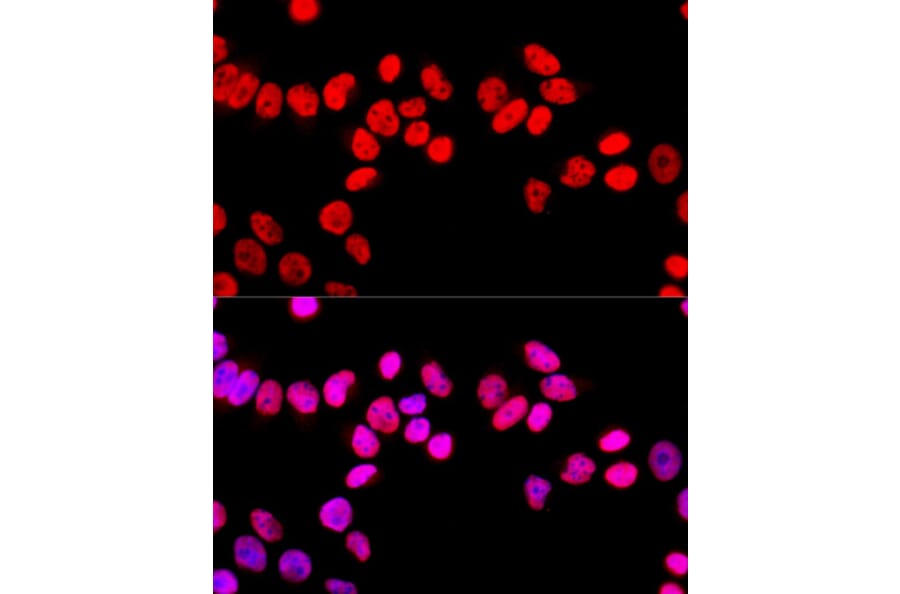 Immunofluorescence - Anti-SFPQ Antibody (A12722) - Antibodies.com