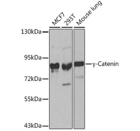 Western Blot - Anti-gamma Catenin Antibody (A12724) - Antibodies.com