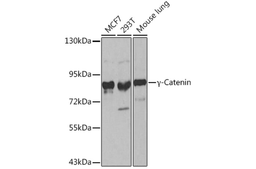Western Blot - Anti-gamma Catenin Antibody (A12724) - Antibodies.com