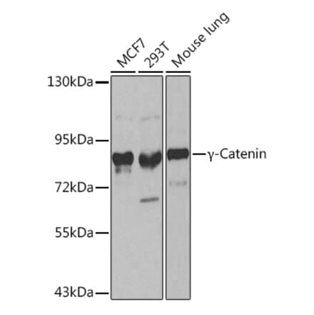 Western Blot - Anti-gamma Catenin Antibody (A12724) - Antibodies.com