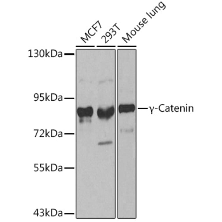 Western Blot - Anti-gamma Catenin Antibody (A12724) - Antibodies.com