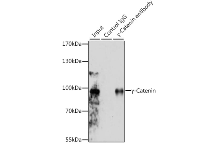 Western Blot - Anti-gamma Catenin Antibody (A12724) - Antibodies.com