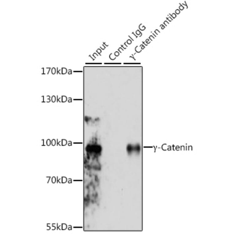 Western Blot - Anti-gamma Catenin Antibody (A12724) - Antibodies.com