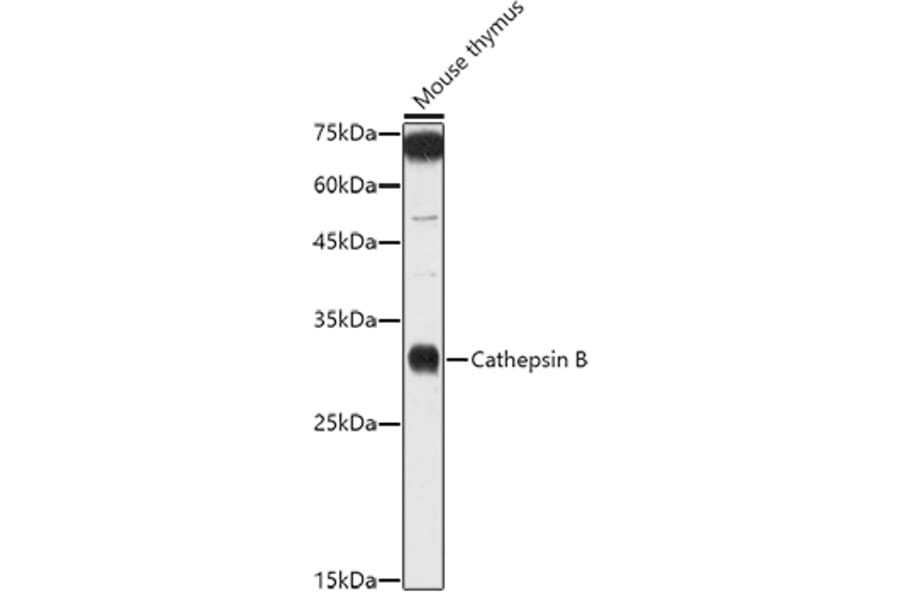 Western Blot - Anti-Cathepsin B Antibody (A12726) - Antibodies.com