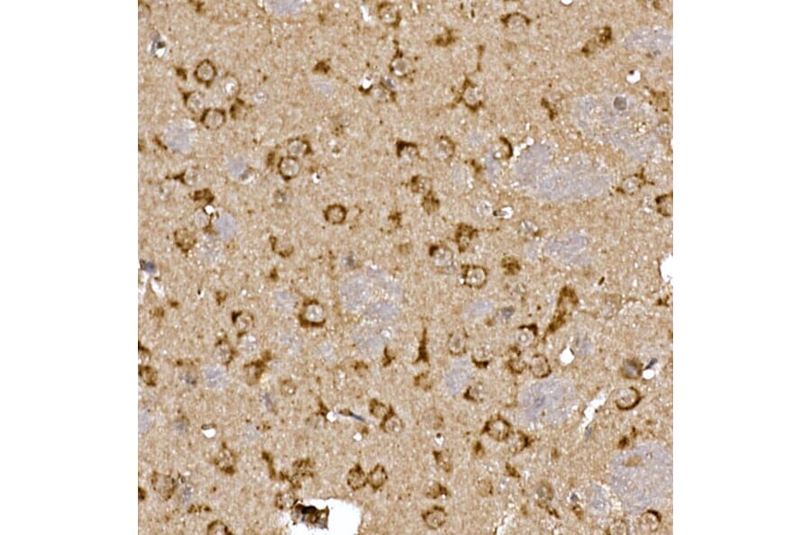 Immunohistochemistry - Anti-Cathepsin B Antibody (A12726) - Antibodies.com