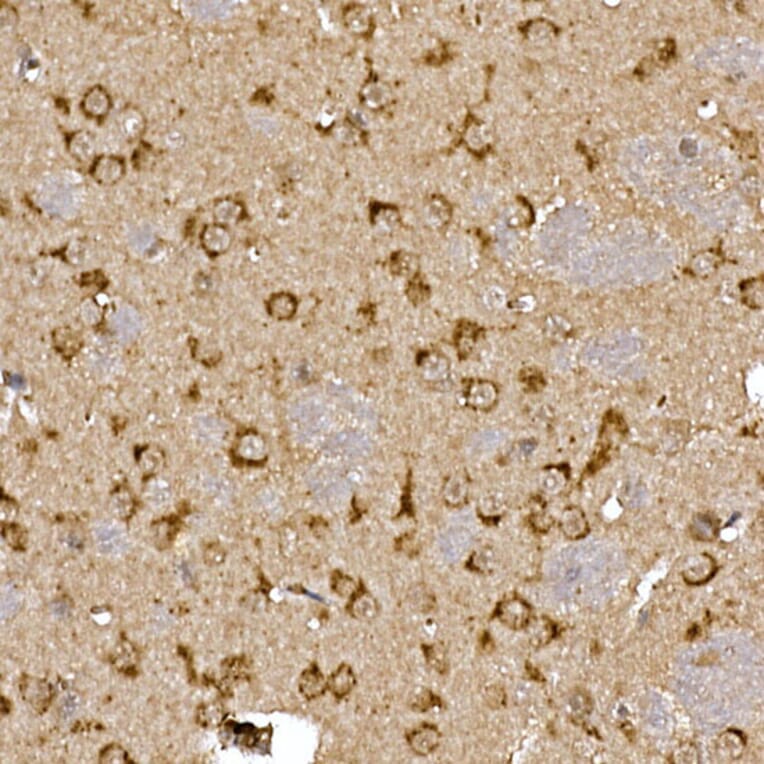 Immunohistochemistry - Anti-Cathepsin B Antibody (A12726) - Antibodies.com