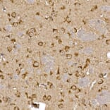 Immunohistochemistry - Anti-Cathepsin B Antibody (A12726) - Antibodies.com