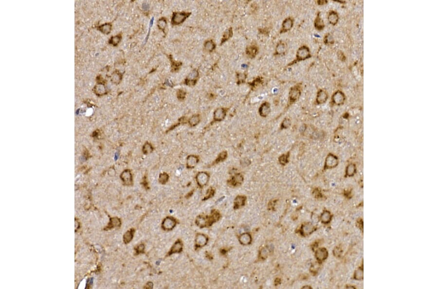 Immunohistochemistry - Anti-Cathepsin B Antibody (A12726) - Antibodies.com