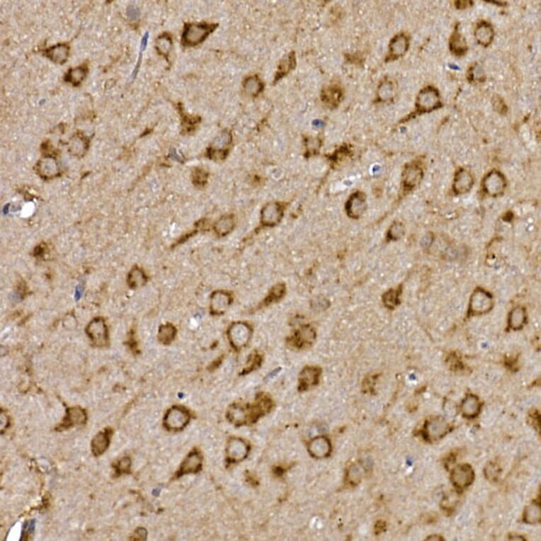 Immunohistochemistry - Anti-Cathepsin B Antibody (A12726) - Antibodies.com