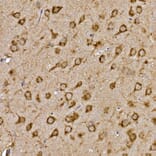 Immunohistochemistry - Anti-Cathepsin B Antibody (A12726) - Antibodies.com