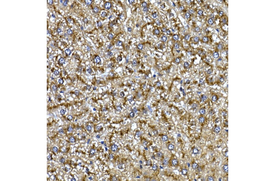 Immunohistochemistry - Anti-Cathepsin B Antibody (A12726) - Antibodies.com