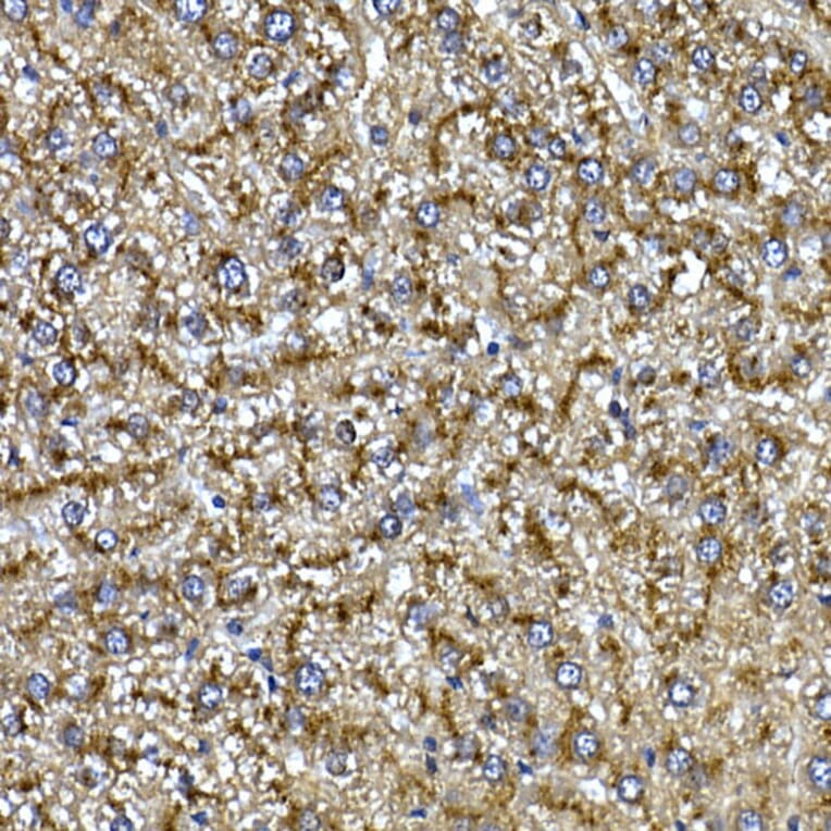 Immunohistochemistry - Anti-Cathepsin B Antibody (A12726) - Antibodies.com
