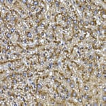 Immunohistochemistry - Anti-Cathepsin B Antibody (A12726) - Antibodies.com