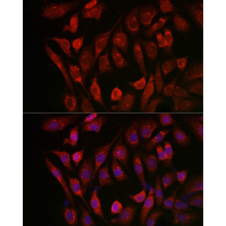 Immunofluorescence - Anti-Cathepsin B Antibody (A12726) - Antibodies.com